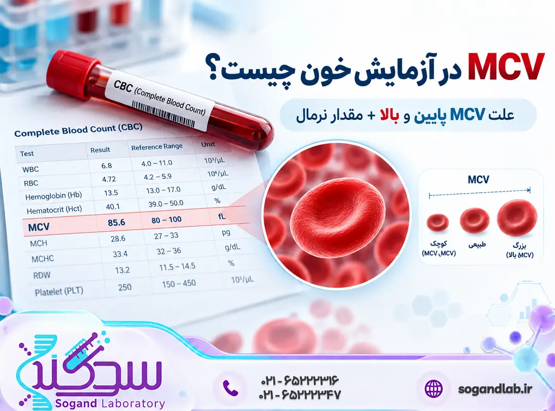  MCV در آزمایش خون چیست؟ MCV پایین، بالا و مقدار نرمال